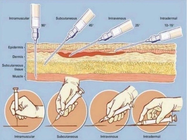 Jak napravit injekce