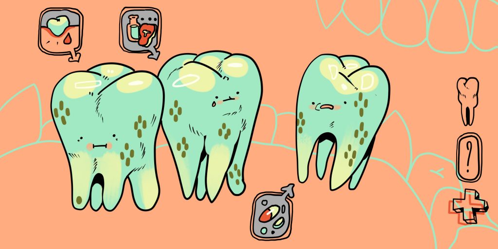 V tmavých skvrnách na zubech není špatná hygiena na vině. Odtud pochází nálet prémie a jak se toho zbavit