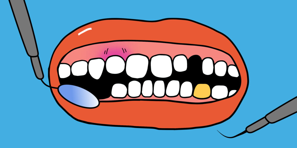 Co dělat, když se zub potápí